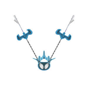 dispositivo para reparação de fraturas vertebrais com balão