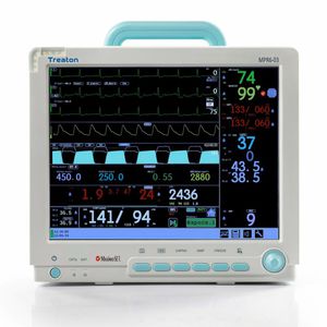 monitor de paciente de ECG