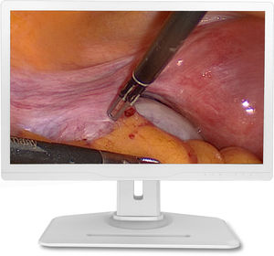 monitor para endoscopia