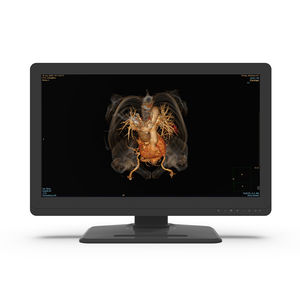 monitor de diagnóstico
