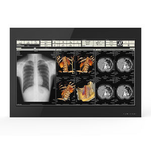 monitor médico-hospitalar