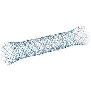 stent colônico