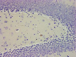 kit de reagentes hematoxilina de Mayer