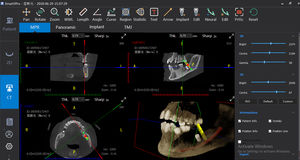 software para imagiologia dentária