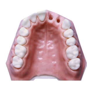 modelo de maxilar