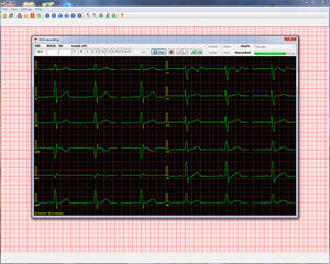 software para eletrocardiografia