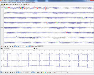 módulo de software para ECG
