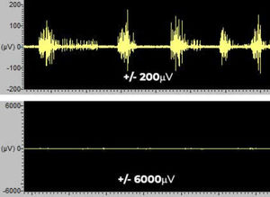 software para EMG