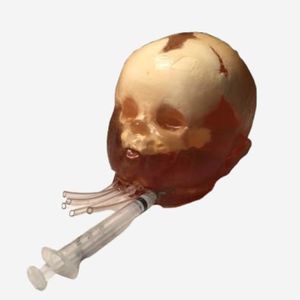 fantoma para radiografia 1