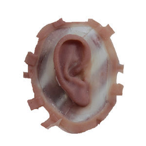 prótese estética auricular