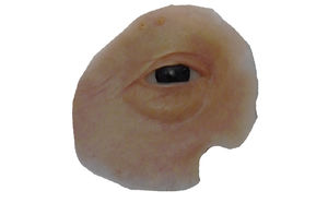 prótese estética orbital