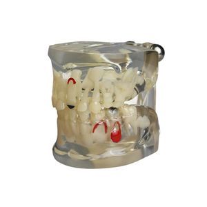 modelo de dente