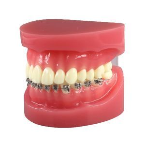 modelo de dente