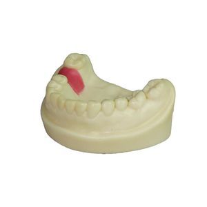 modelo de dente