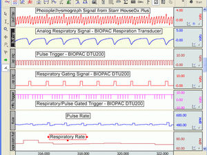 fotopletismógrafo respiratório