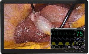 monitor hospitalar