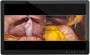 monitor hospitalar