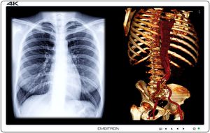 monitor para sala de cirurgia