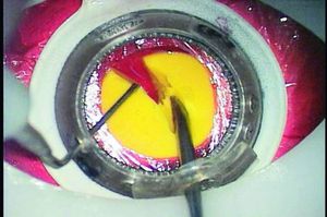simulador para cirurgia de catarata / de treinamento / em kit