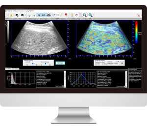 software para ecografia