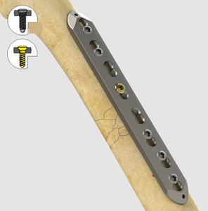 placa de compressão óssea para grandes fragmentos ósseos 1