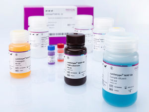 kit de teste para doenças infecciosas