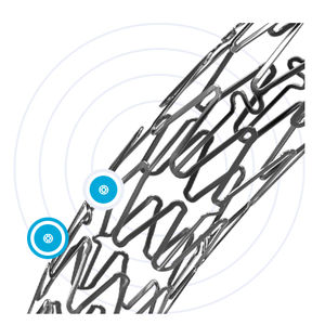 stent coronário 1