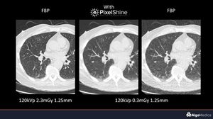 software para imagens médicas