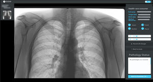software para radiologia