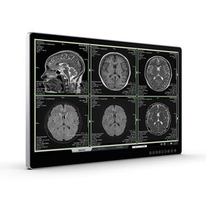 monitor para exames de imagem
