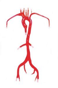 modelo vascular de artéria femoral