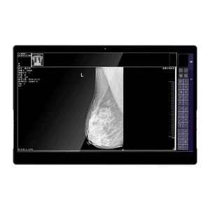 monitor médico