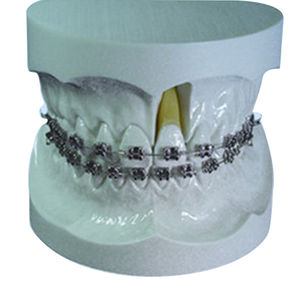 modelo anatômico de dentição 1