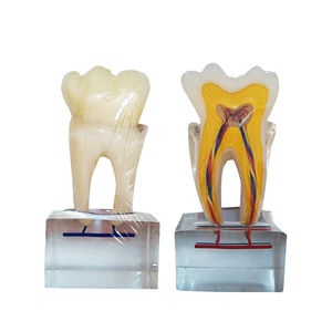 modelo de dente