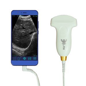 aparelho de ultrassom de bolso