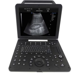 aparelho de ultrassom portátil