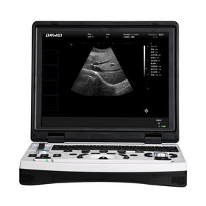 aparelho de ultrassom portátil