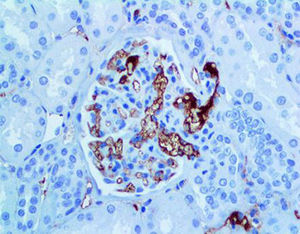 reagente anticorpo monoclonal 1