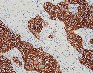 reagente anticorpo monoclonal