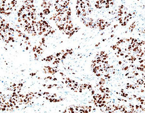 reagente anticorpo monoclonal 1