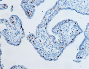 reagente anticorpo monoclonal 1