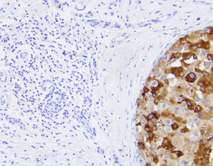 reagente anticorpo monoclonal 1
