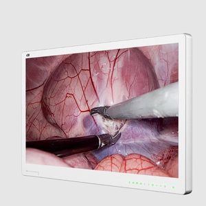 monitor para endoscopia