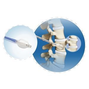 kit de instrumentos para cifoplastia percutânea