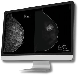 software para tomossíntese mamária