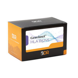 kit de reagentes transcriptase reversa 1