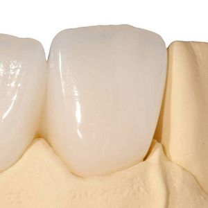 material dentário em resina acrílica 1