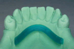material dentário em cera 1