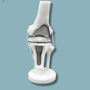 modelo anatômico de fêmur