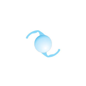 lente intraocular monofocal